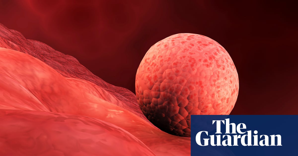 Scientists create replica human womb lining and implant early-stage embryos | Reproduction