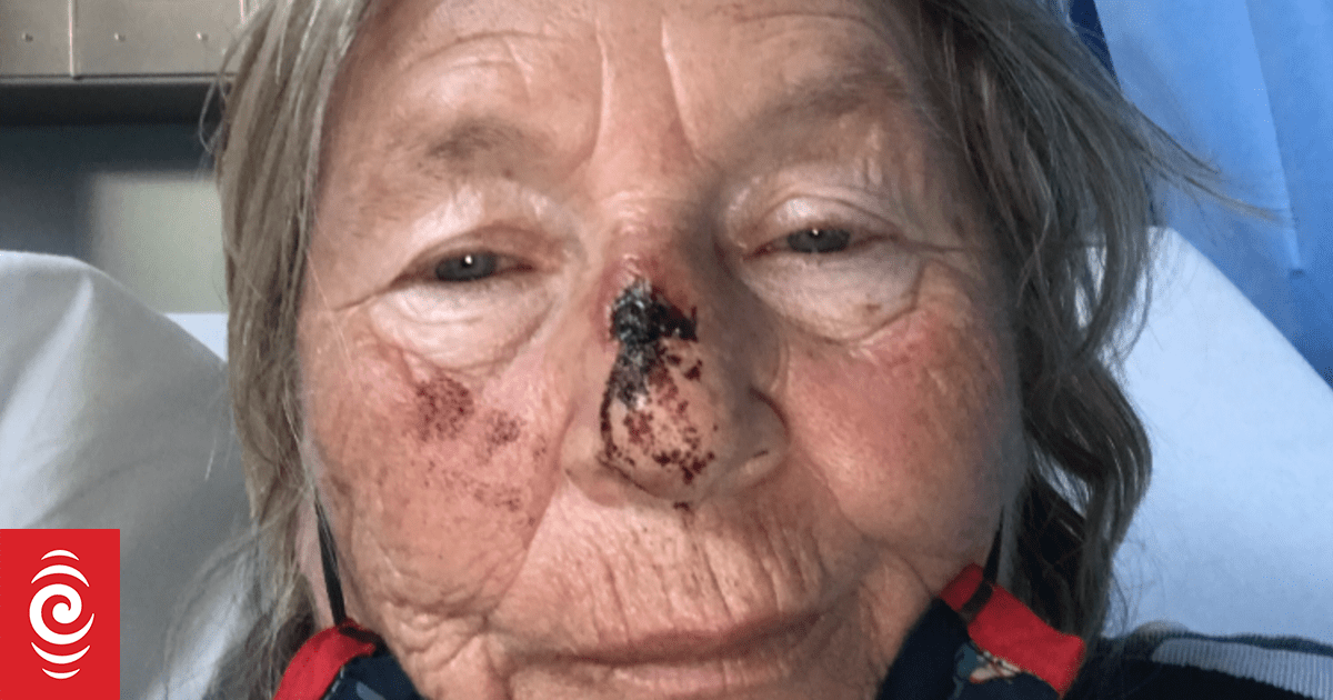 Dream fishing charter trip ends in nightmare after two injured crossing infamous Pātea bar