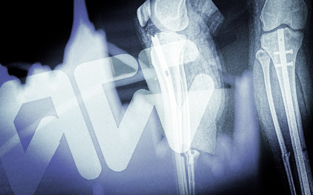 Stylised composite of ACC logo, x-rays and chart.