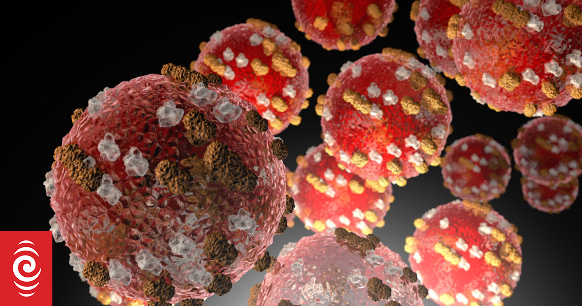 Three new measles cases - two in Auckland and one in Wellington, Health New Zealand says