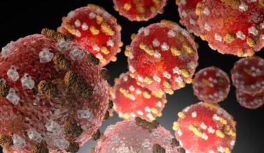 Measles case in Dunedin among 'concerning' rise