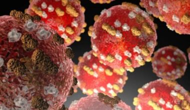 More measles case locations identified