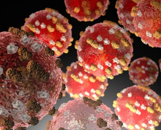 More measles case locations identified