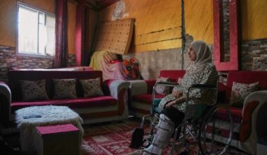 Gaza amputees struggle to rebuild lives as enclave faces shortages of prosthetic limbs