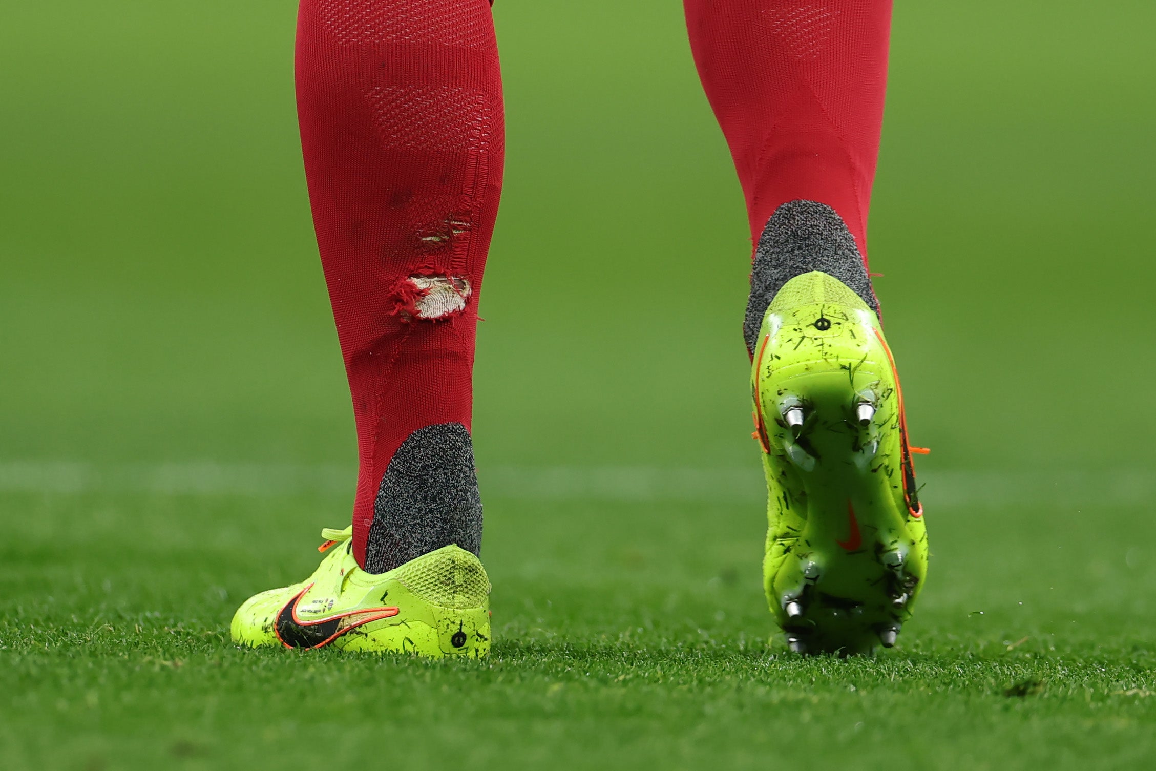The damage done to Virgil van Dijk’s sock after Simons’ challenge