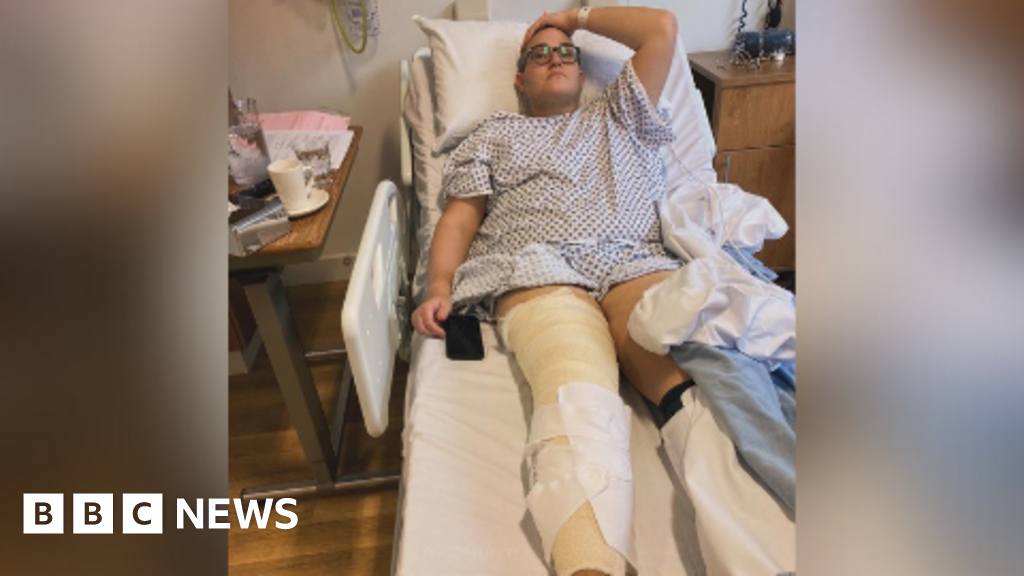 Manchester man kneed in leg by TUI staff on holiday paid £18k