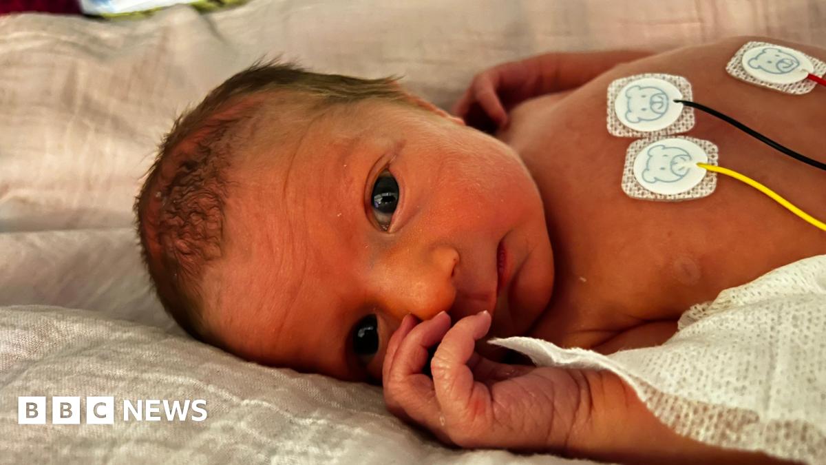 Baby Willow lying in a bed in the neonatal unit at the John Radcliffe Hospital in Oxford. She has wires on her chest and has her eyes open.