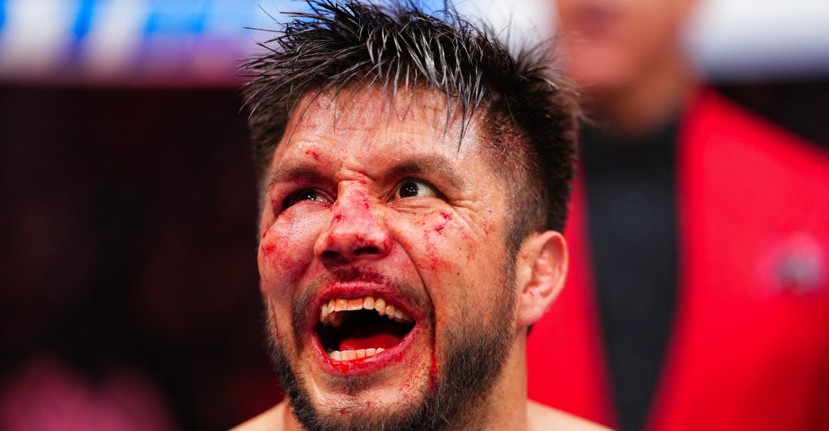 Henry Cejudo shows off bloody, bruised, and swollen face after final fight at UFC 323