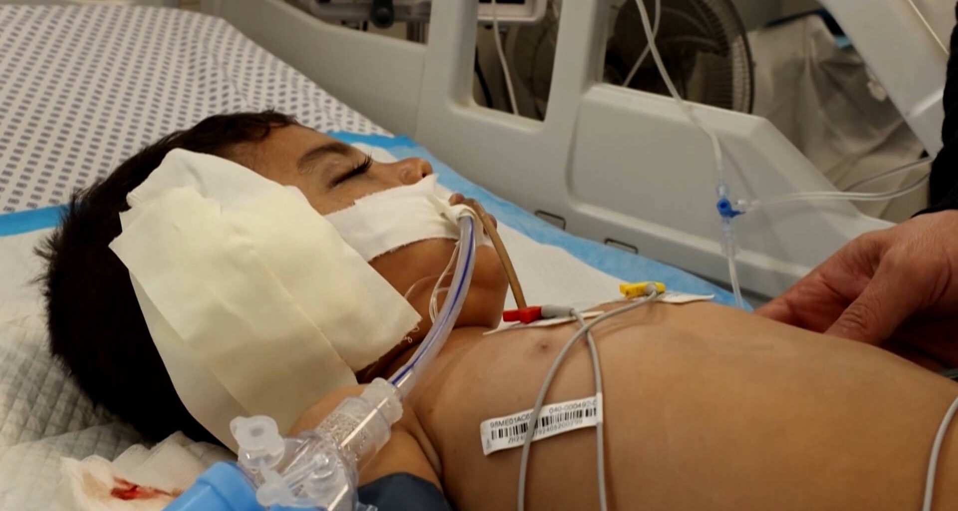 WHO Declares Gaza No Longer Faces Famine, But Progress Remains Extremely Fragile - Democracy Now!