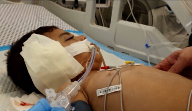 WHO Declares Gaza No Longer Faces Famine, But Progress Remains Extremely Fragile - Democracy Now!