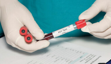 Startling rise in number of women being diagnosed with HIV in Ireland - The Journal