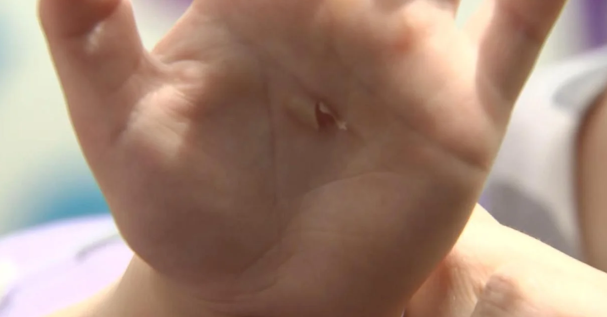 Children suffer chemical burns after being exposed to a hazardous substance on a slide in their Christchurch daycare