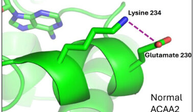 Rare genetic disorder linked to liver dysfunction, hypoglycemia, lipodystrophy : Newsroom