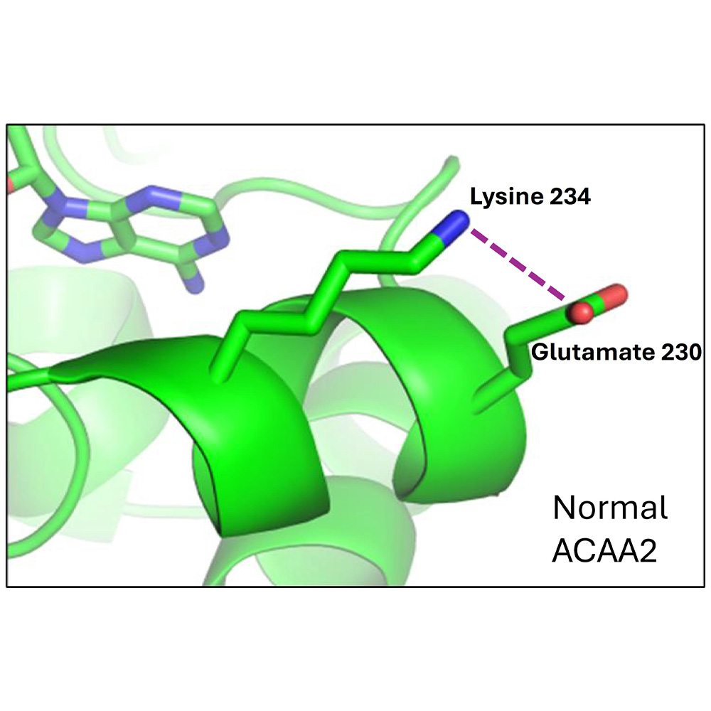 Rare genetic disorder linked to liver dysfunction, hypoglycemia, lipodystrophy : Newsroom