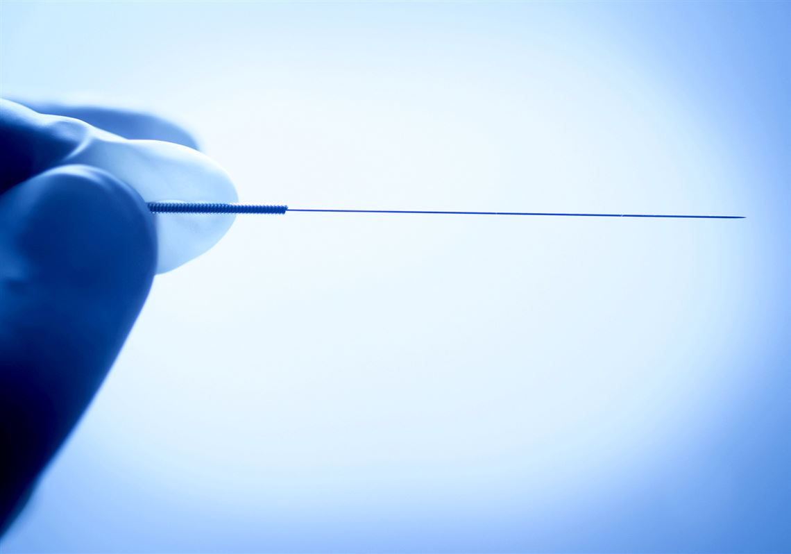 What is dry needling and what are its risks? What to know after Steeler T.J. Watt's lung partially collapsed