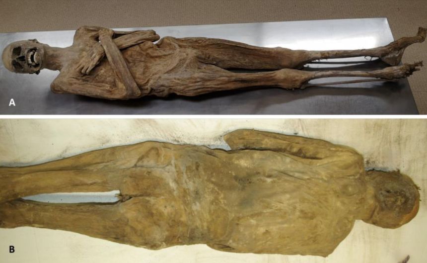 The mummy's external appearance from the front (A) and back (B) showed no incisions on the body.