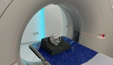 Bosnia and Herzegovina Improves Radiation Protection for Children at Six Hospitals