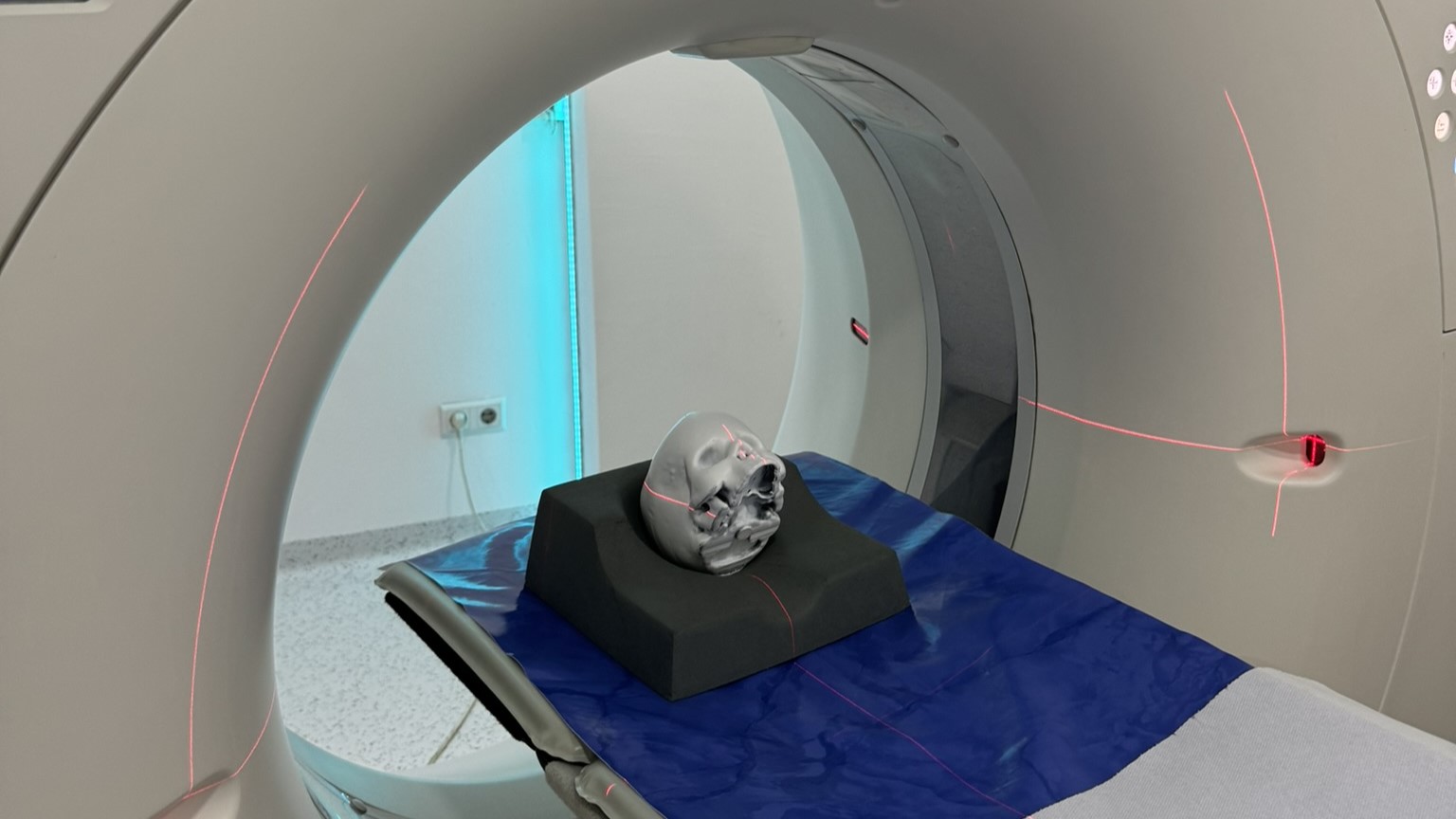 Bosnia and Herzegovina Improves Radiation Protection for Children at Six Hospitals