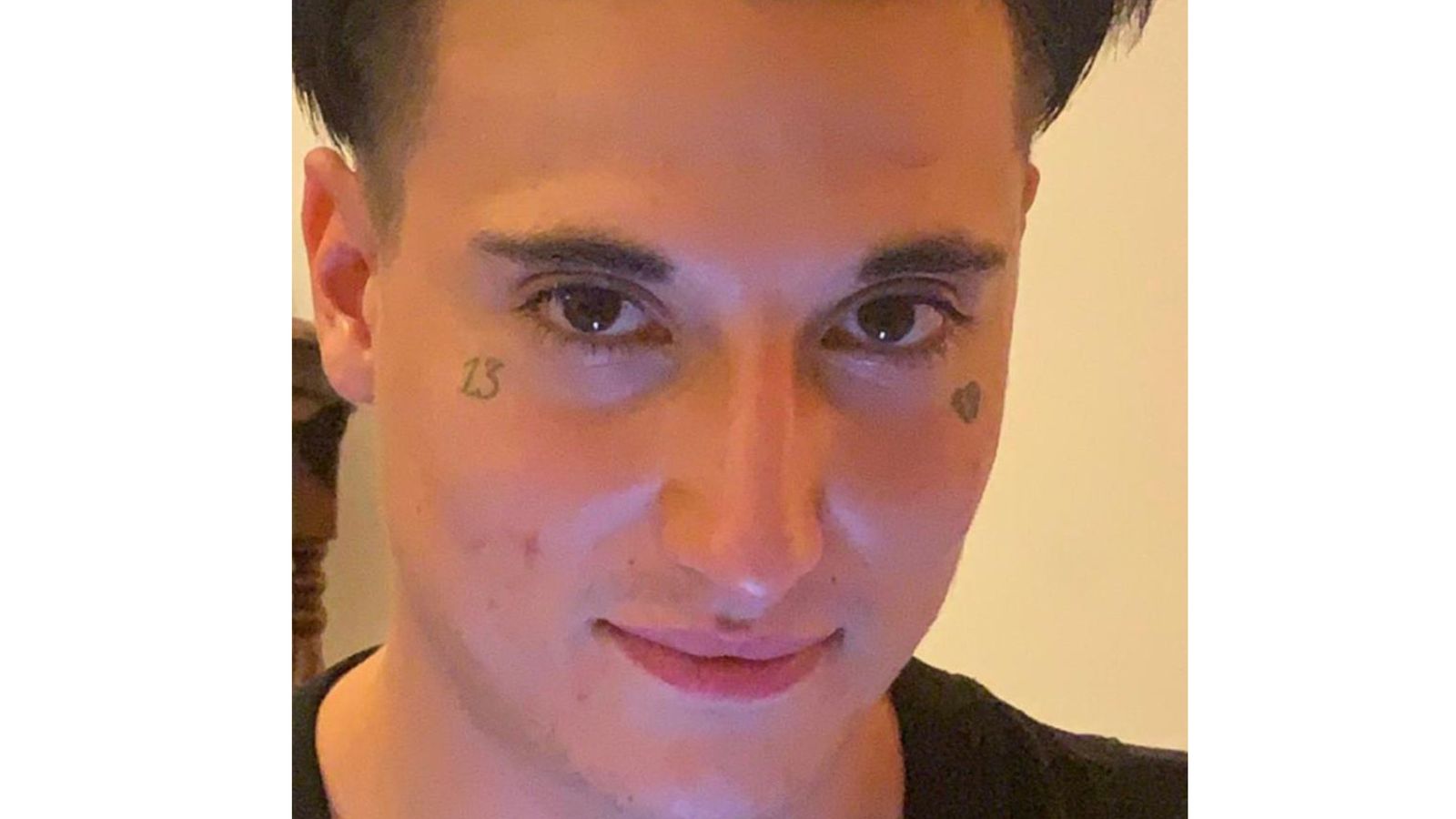 Aidan Chapman's life support was turned off on New Year's Eve. Pic: Met Police