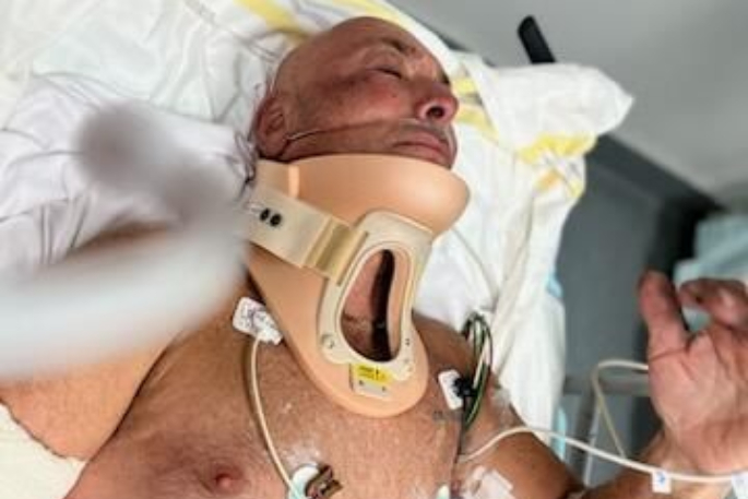 SunLive - Cyclist injured after being hit by ute mirror