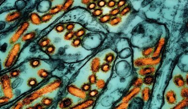 Colourised transmission electron micrograph of avian influenza A H5N1 virus particles.