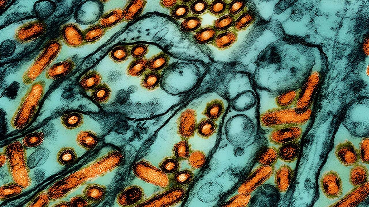 Colourised transmission electron micrograph of avian influenza A H5N1 virus particles.