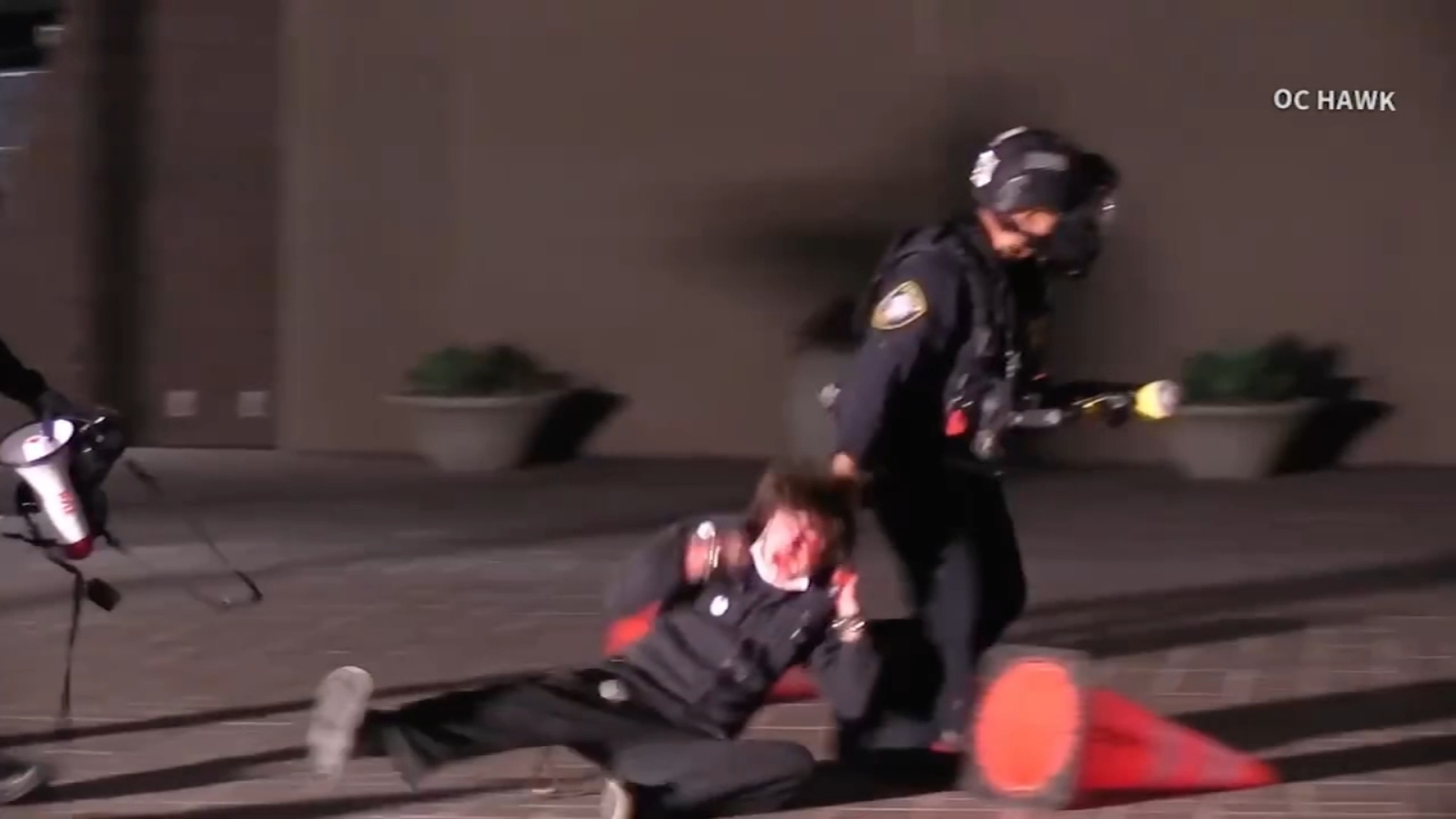 Protester blind in left eye after federal agent fired projectile during Santa Ana protest, family says