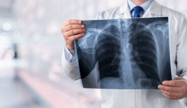 Deaths in Canada due to pneumonia rose by 20 per cent in 2024