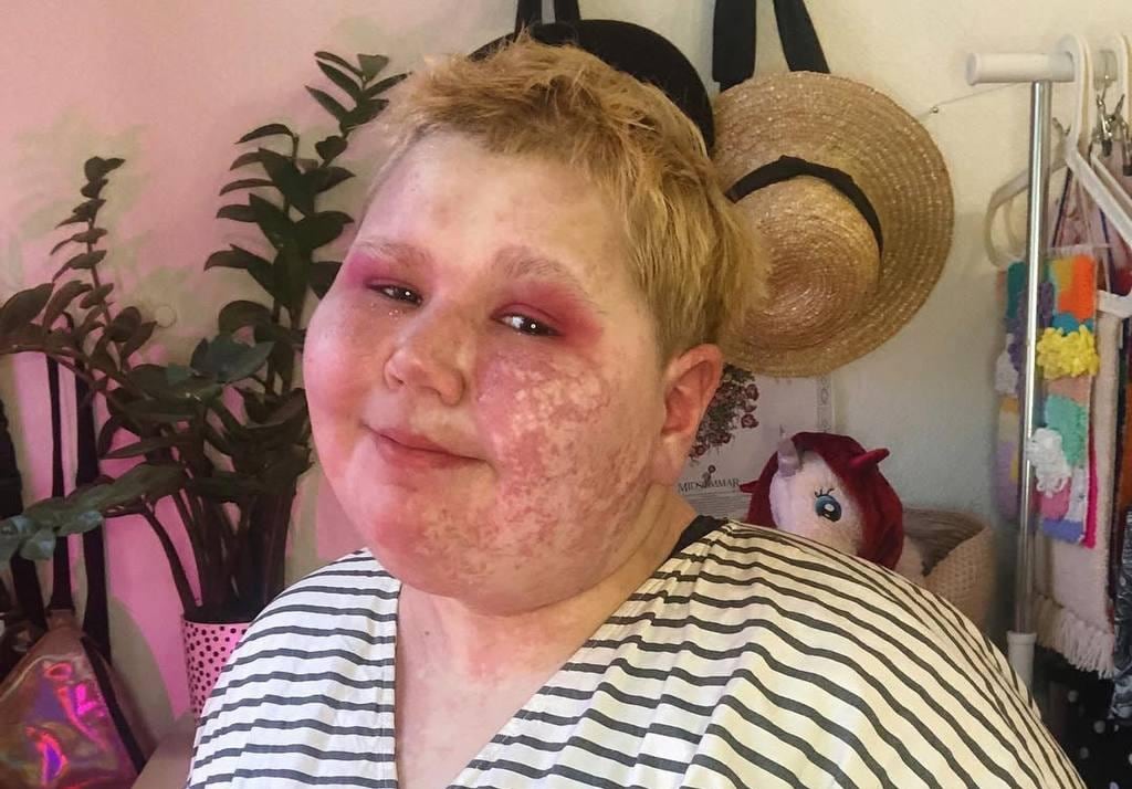 Oli, who left Russia in 2022 due to its repressive laws, works with the LGBTQ+ community while living abroad.