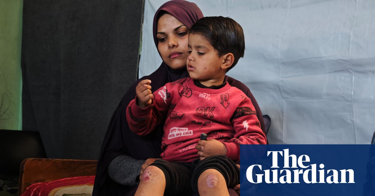 ‘I wish I had the power to ease his suffering’: Gaza’s cancer patients trapped by war and blockade | Gaza