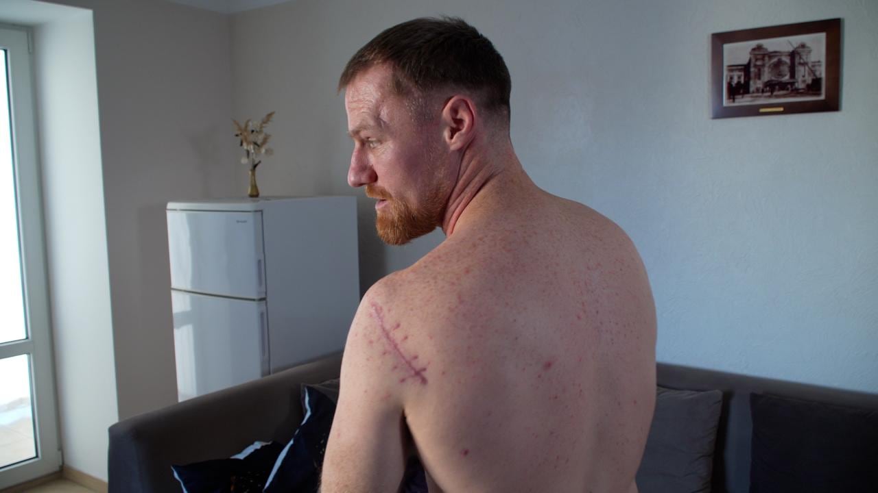 David Rauser spent nearly two months in the hospital after being shot in the arm and in the head during a friendly fire incident in eastern Ukraine.