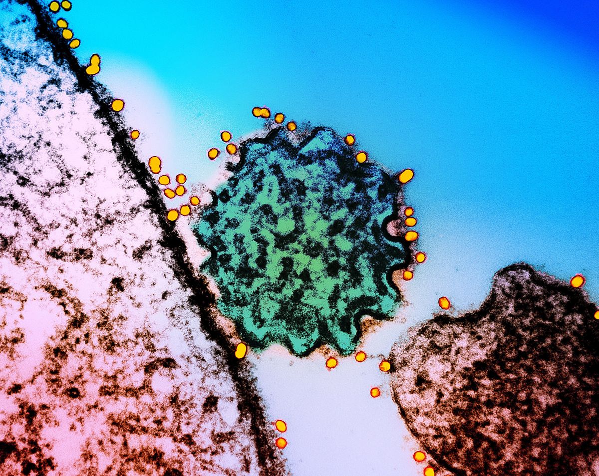 A photo of Nipah virus cells 