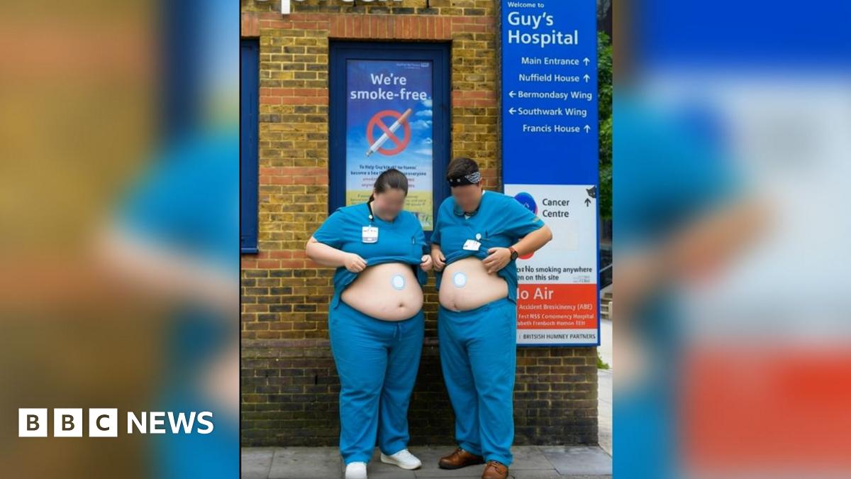 A screen grab of a promotional video showing two doctors in scrubs, outside Guy's hospital placing weight loss patches on their stomachs