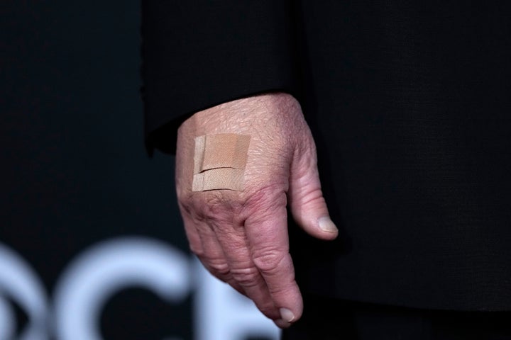 A bandage is seen on the hand of President Donald Trump while he walks the red carpet before the 48th Kennedy Center Honors on Dec. 7 at the John F. Kennedy Center for the Performing Arts in Washington.