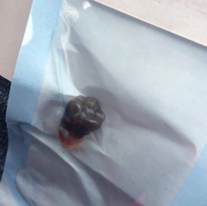 A small tooth inside a clear plastic bag placed on top of a light surface