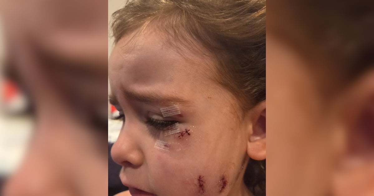 Moms describe attack by dogs that mauled four-year-old girl in Oshawa