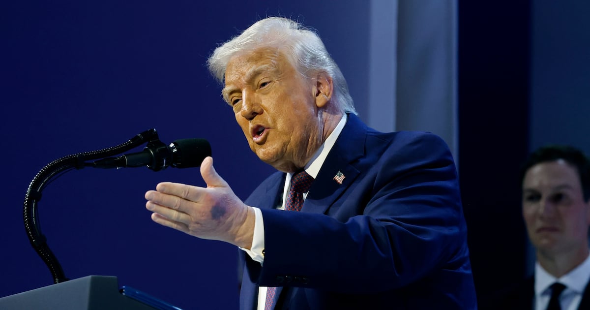 Jon Stewart’s 'Daily Show' Suggests Diagnosis for Trump’s Gnarly Hand Bruises