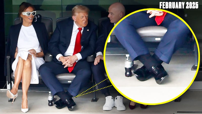 Donald Trump's cankles are often seen spilling over his shoes.