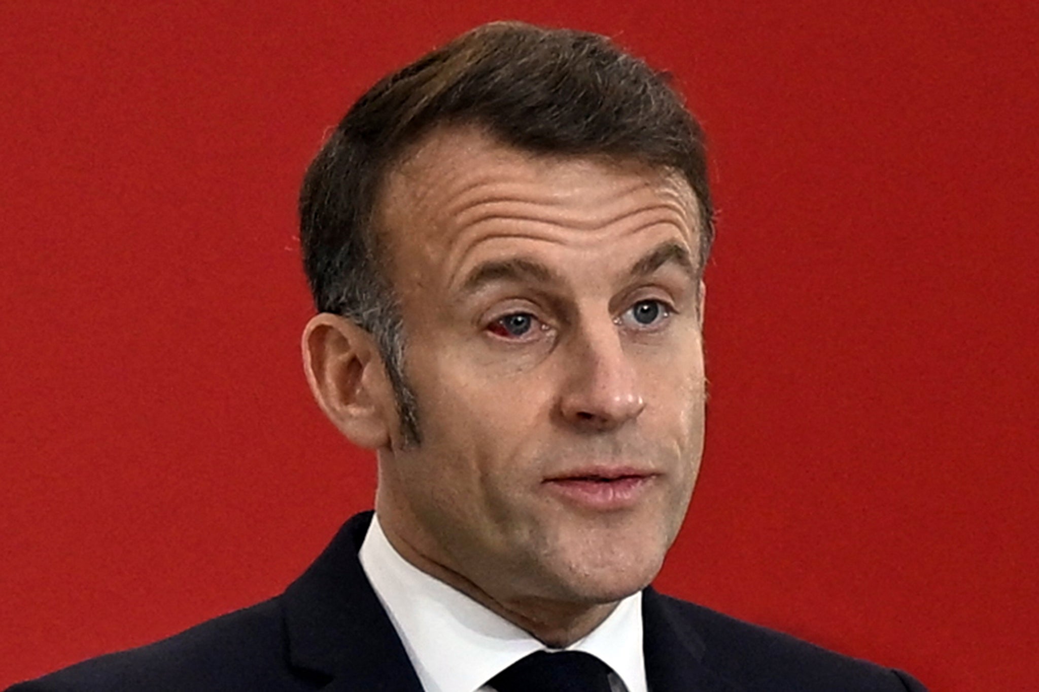 Emmanuel Macron has insisted his eye condition is ‘totally benign’