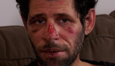 ‘I had a guardian angel over me’: Sarnia man recounts harrowing ordeal after being run over by car - CTV News