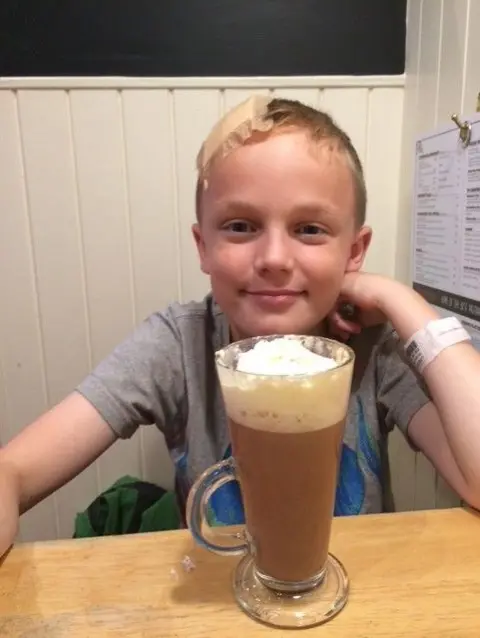 Claire Lindsay Young boy with large plaster on the right side of his head. He is sitting behind a huge hot chocolate with lots of cream on top. He has a hospital ID band on his wrist. 