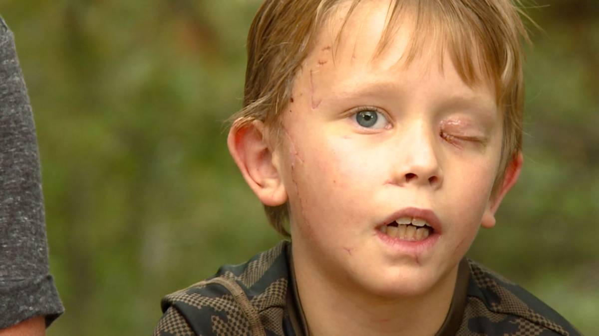 Click to play video: 'An 8-year-old boy narrowly escaped death after being attacked by a mountain lion'