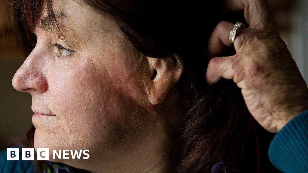 What to know about 'flashover fire' dangers