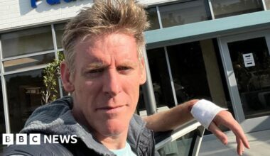 'I survived shark attack during swimming challenge'