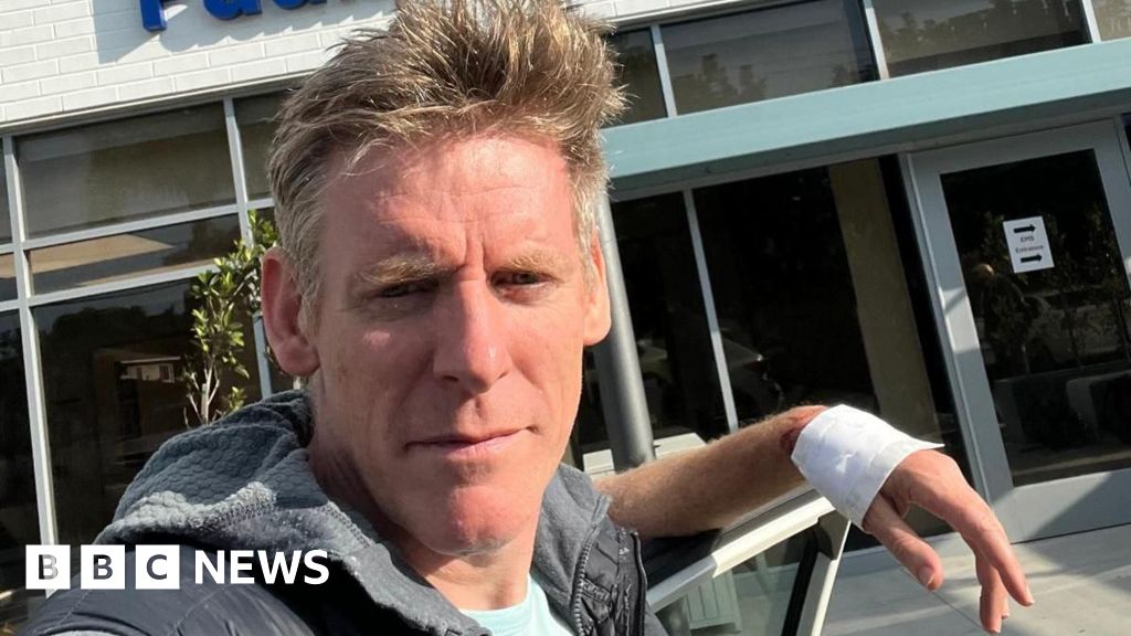 'I survived shark attack during swimming challenge'