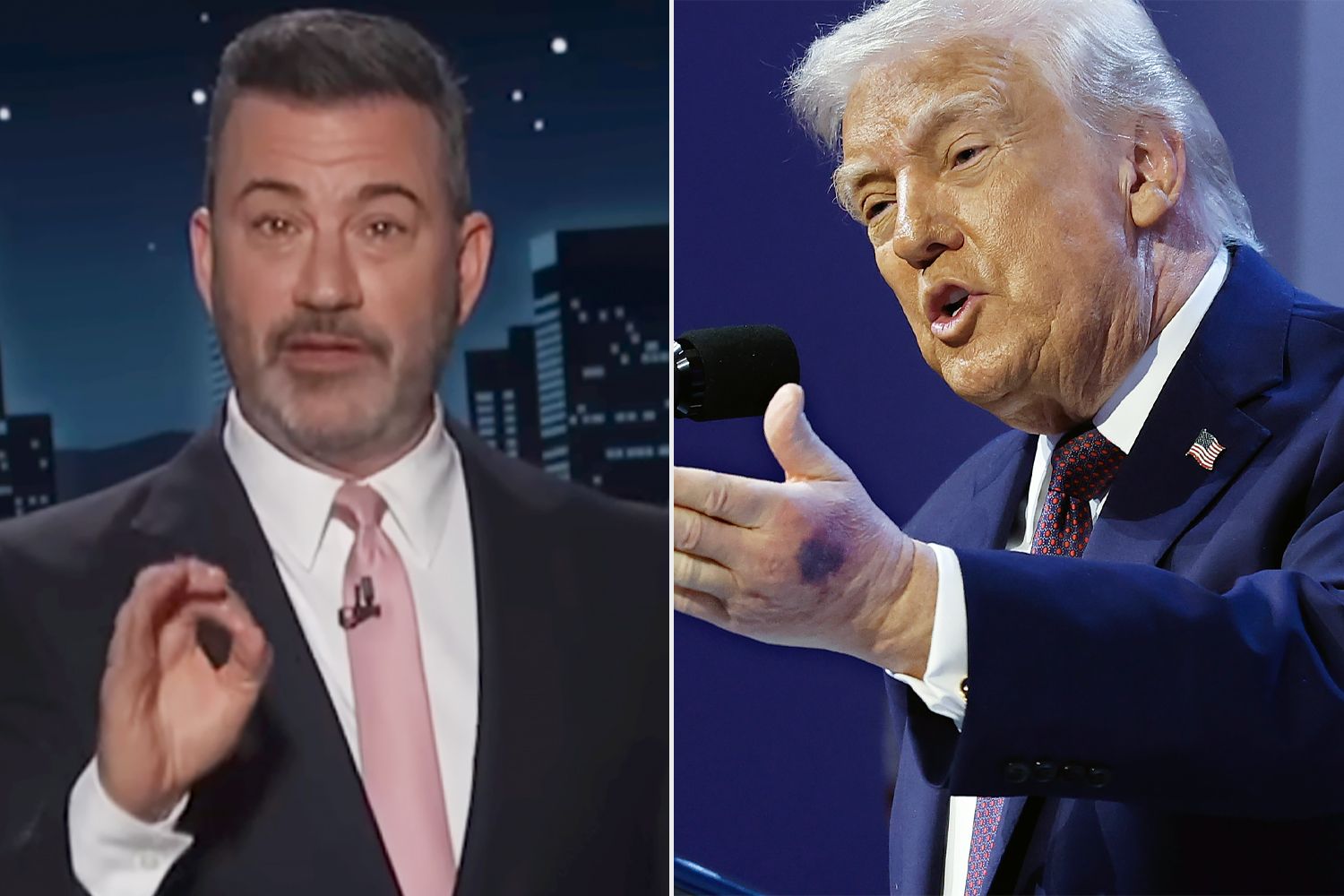 Jimmy Kimmel interviews Trump's bruised hand in late-night segment