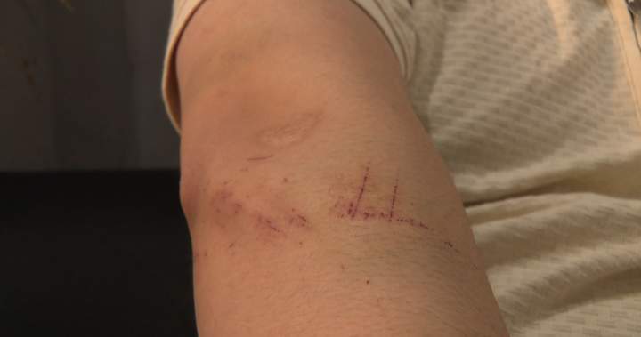 Calgary police charge 2 teens in Facebook Marketplace robberies