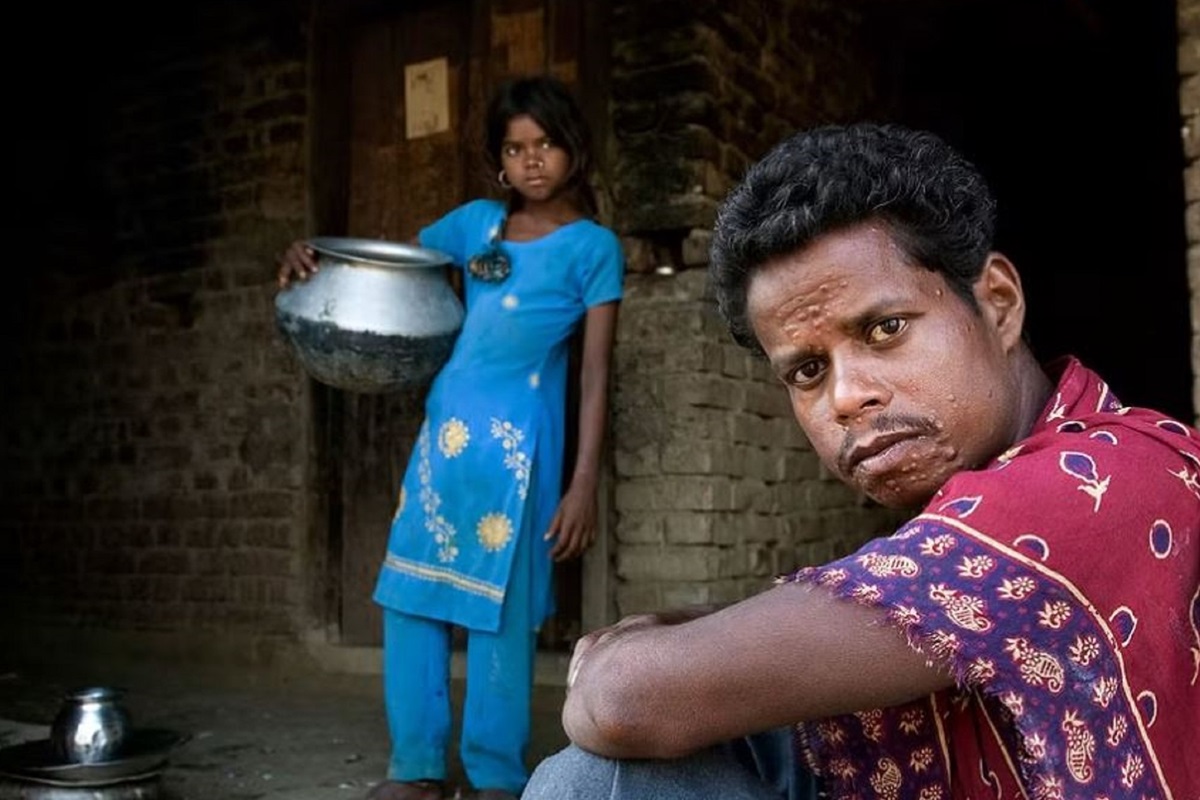 Communities unite to address stigma and discrimination affecting people with neglected tropical diseases