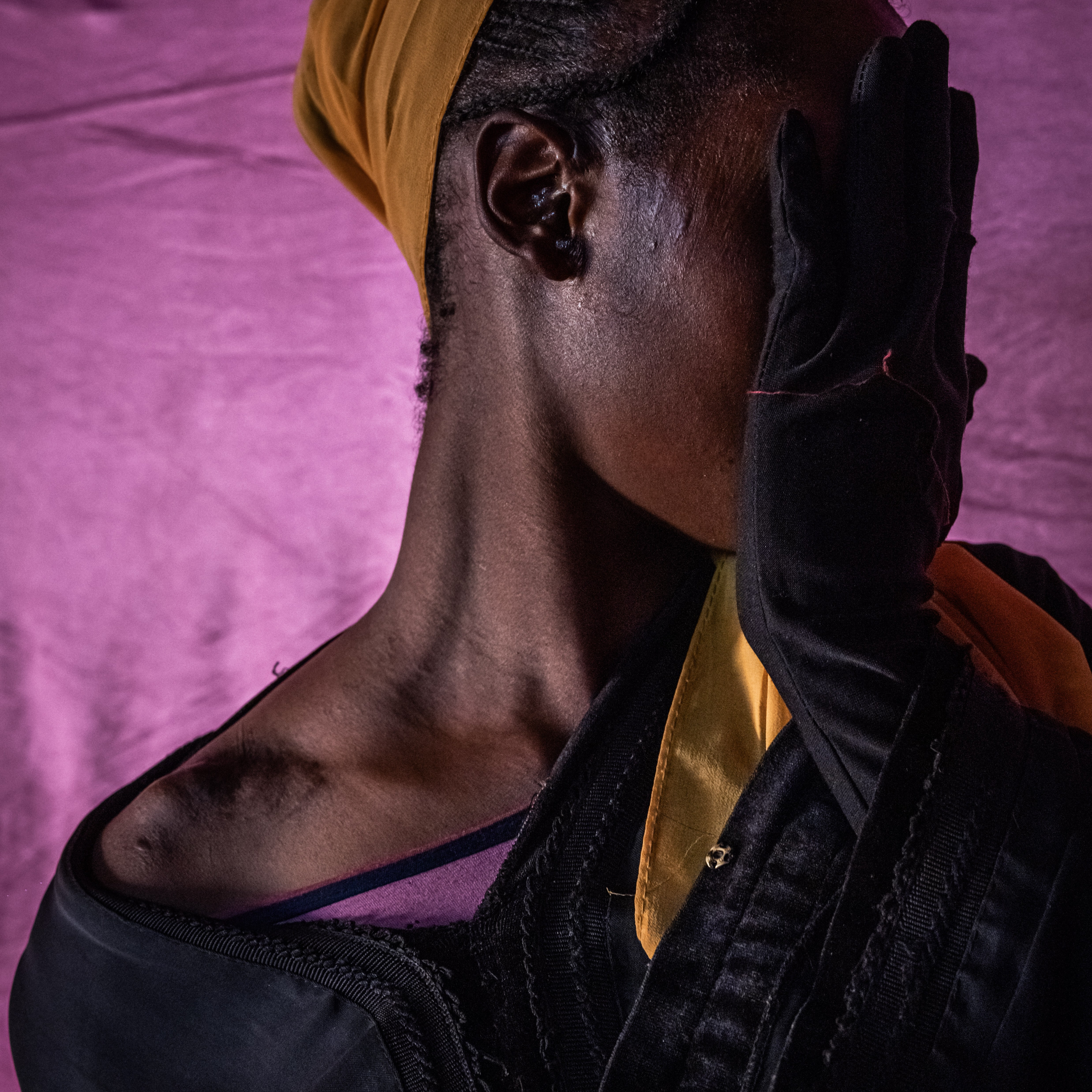 Fuda, a survivor of sexual abuse, covers her face and reveals scars on her shoulder and ear.