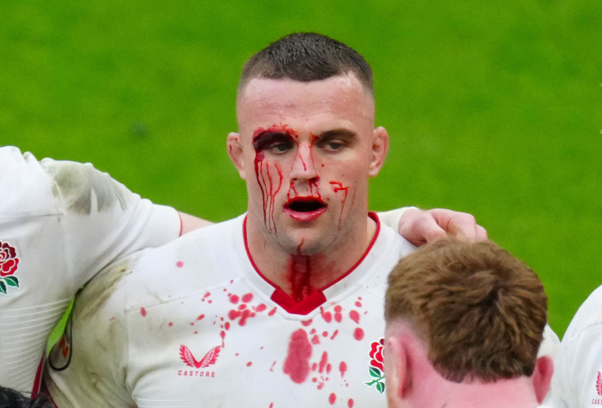 Ben Earl of England with blood on his face during a rugby match.
